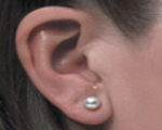 IIC hearing aid
